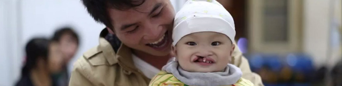 A father and child at an Operation Smile mission clinic